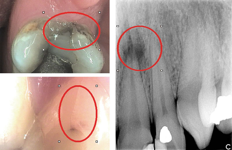 Co-diagnosis